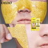 Tearing Mask Deep Acne Exfoliating Mask - Gold